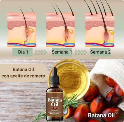2X1 ACEITE DE BATANA PARA EL CRECIMIENTO DE CABELLO